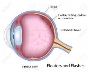 Floaters and Flashes- Retina Ophthalmologist in Gettysburg PA